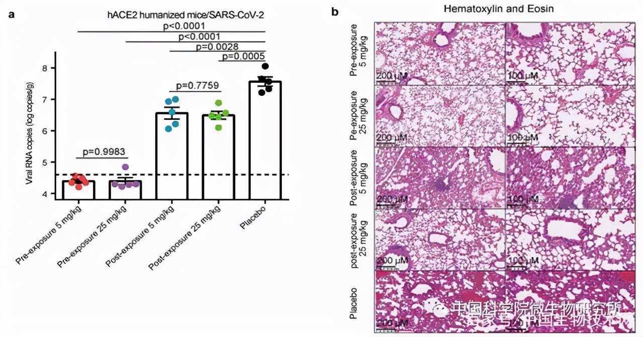 h11B11单抗预防和治疗小鼠感染新冠病毒