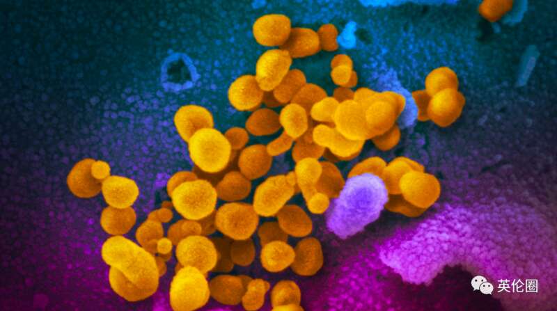 英国卫生安全局(UKHSA)透露,在一名感染者身上发现了Deltacron变种病毒 英国卫生安全局(UKHSA)透露,在一名感染者身上发现了Deltacron变种病毒