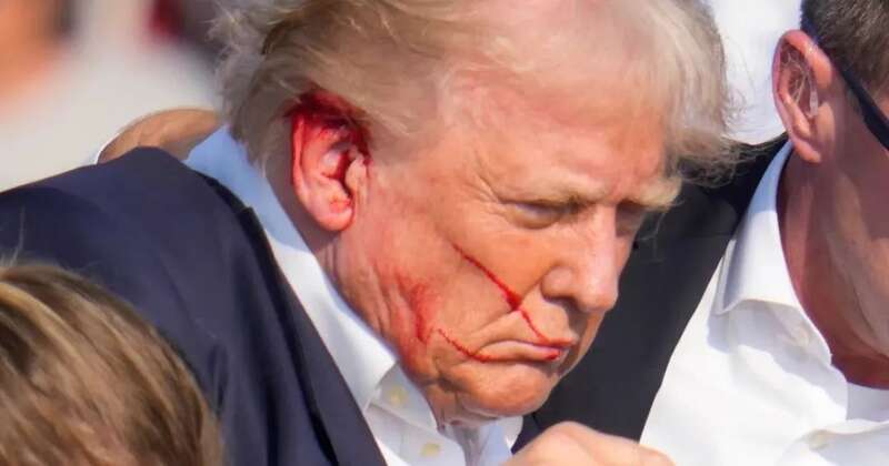 特朗普耳朵流了很多血